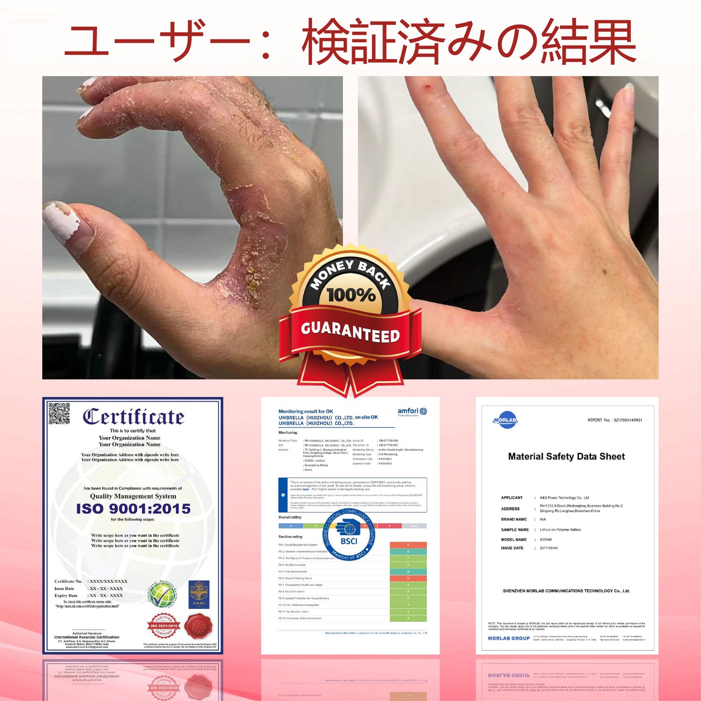 ⭐⭐ATTDX®グルコースガード皮膚保護クリーム