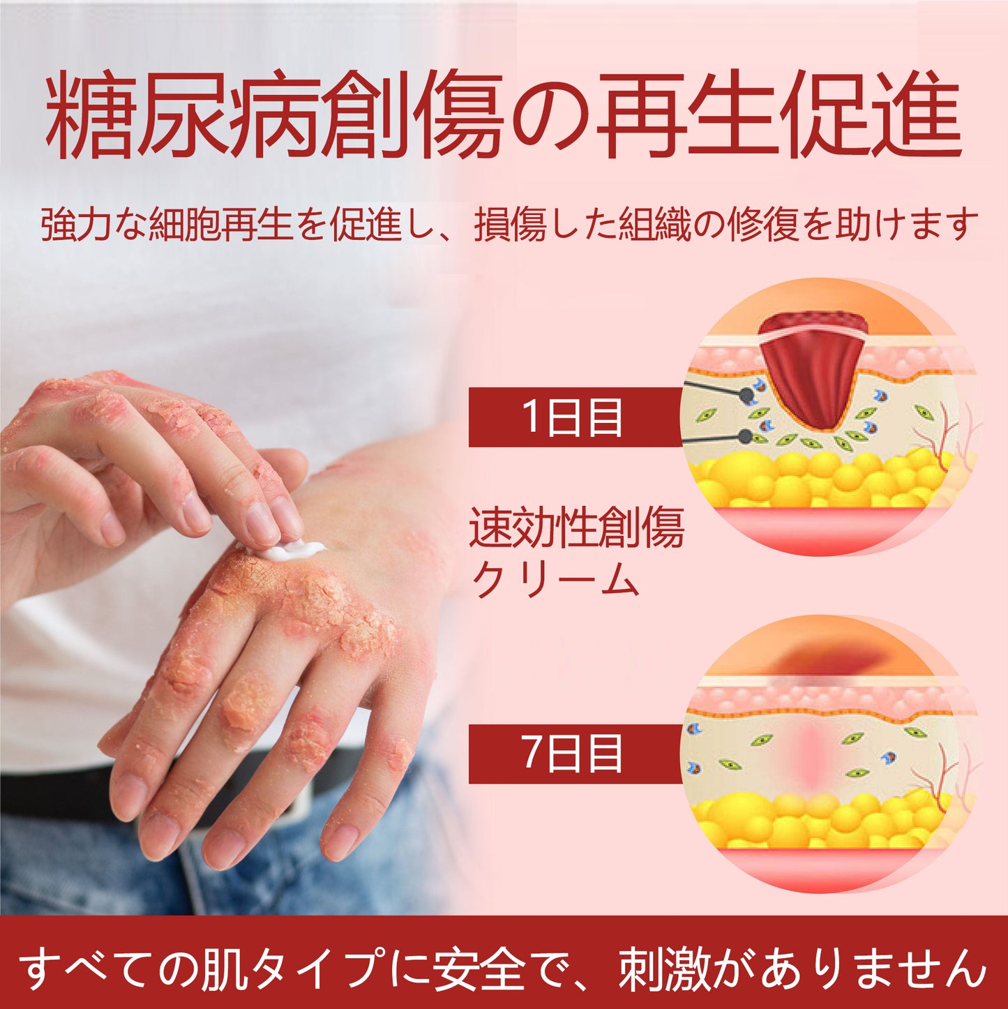 ⭐⭐ATTDX®グルコースガード皮膚保護クリーム