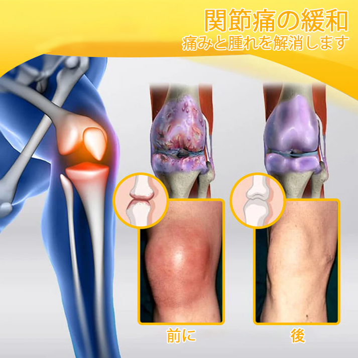 🔥🔥TLOPA®ボツリヌストキシンとビーベノムの骨の痛みを和らげ、癒すバーム🐝（整形外科医がシニアに推奨）🔥。