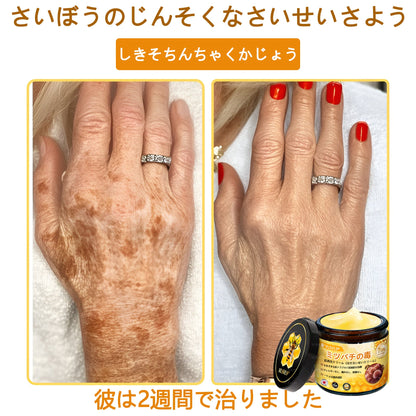 VLSVLS™ 蜂毒配合スキンクリーム（フルケアタイプ）🧑‍⚕️ 皮膚科医も推薦！ 肌トラブル全般に対応した高機能クリームです