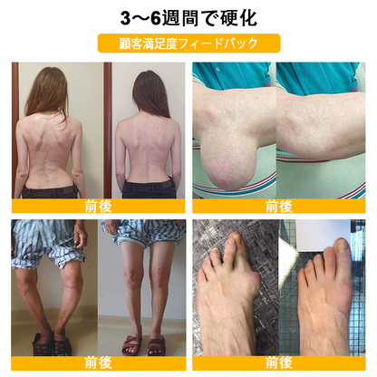 🔥🔥TLOPA®ボツリヌストキシンとビーベノムの骨の痛みを和らげ、癒すバーム🐝（整形外科医がシニアに推奨）🔥。