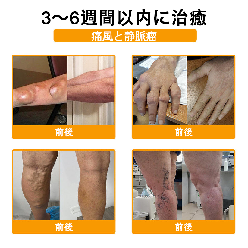 🔥🔥TLOPA®ボツリヌストキシンとビーベノムの骨の痛みを和らげ、癒すバーム🐝（整形外科医がシニアに推奨）🔥。