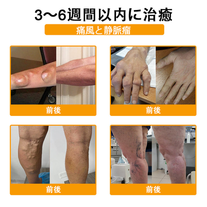 🔥🔥TLOPA®ボツリヌストキシンとビーベノムの骨の痛みを和らげ、癒すバーム🐝（整形外科医がシニアに推奨）🔥。