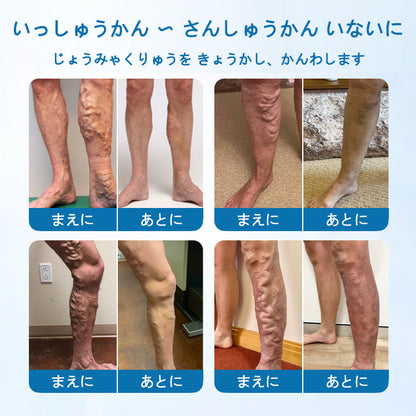 Timilk® VeinGuard Herbal Spray-✅ 臨床的に、わずか7日間で静脈瘤を解消することが証明されています！