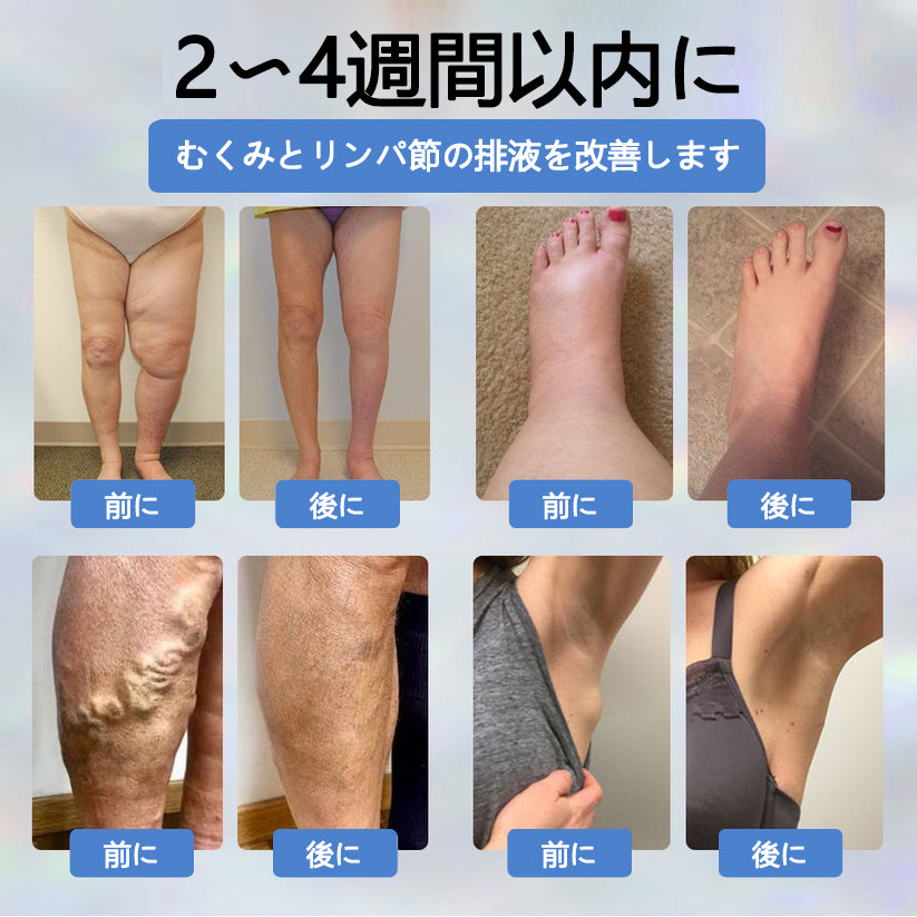 💧ATTDX® 腫れを和らげるハーブクリーム（ブラッククミン配合）