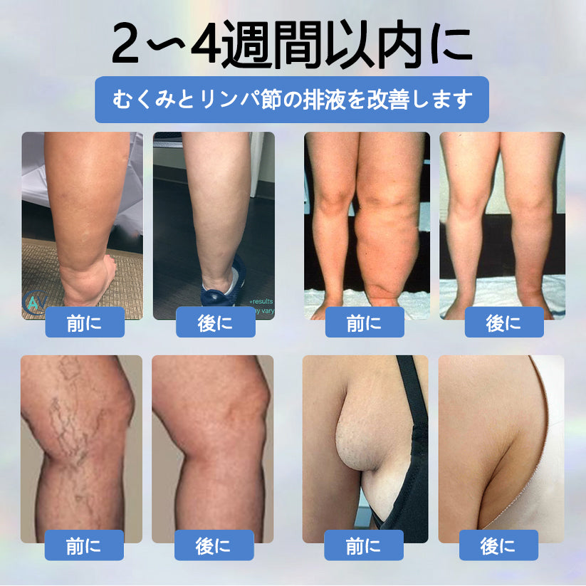 💧ATTDX® 腫れを和らげるハーブクリーム（ブラッククミン配合）