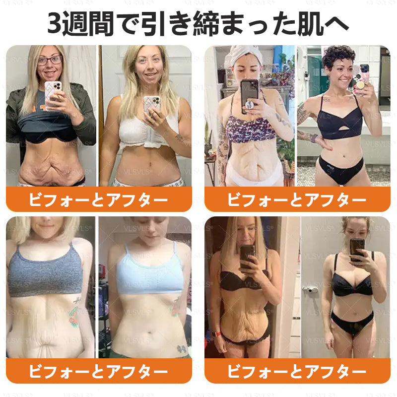 VLSVLS™ 蜂毒配合スキンクリーム（フルケアタイプ）🧑‍⚕️ 皮膚科医も推薦！ 肌トラブル全般に対応した高機能クリームです