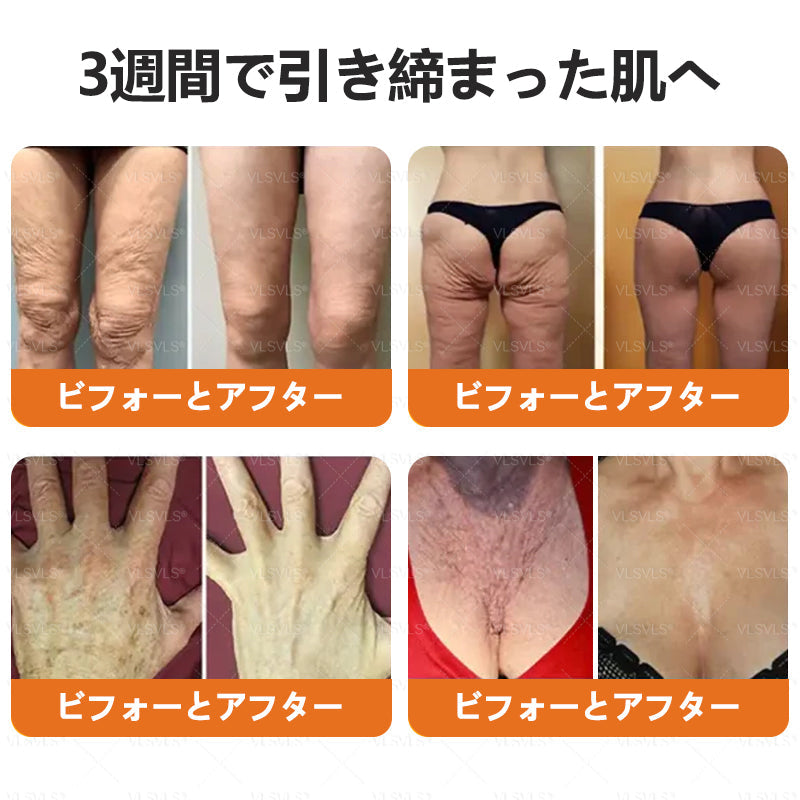 VLSVLS™ 蜂毒配合スキンクリーム（フルケアタイプ）🧑‍⚕️ 皮膚科医も推薦！ 肌トラブル全般に対応した高機能クリームです