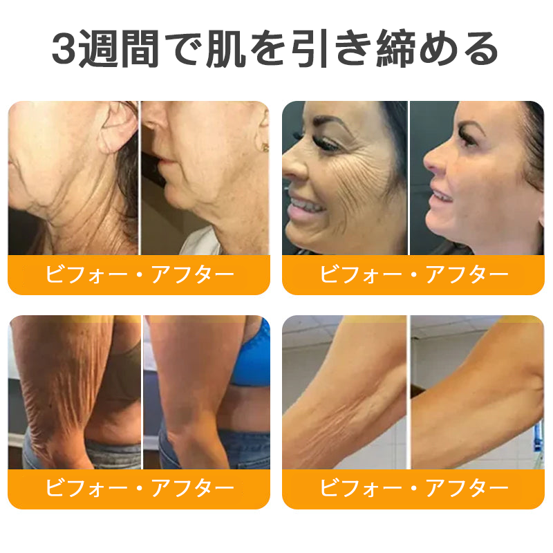 【代金引換可】🌿 TLOPA® 蜂毒スキンリペアクリーム 🔥【最終日】本日限定 80%オフ！🎁