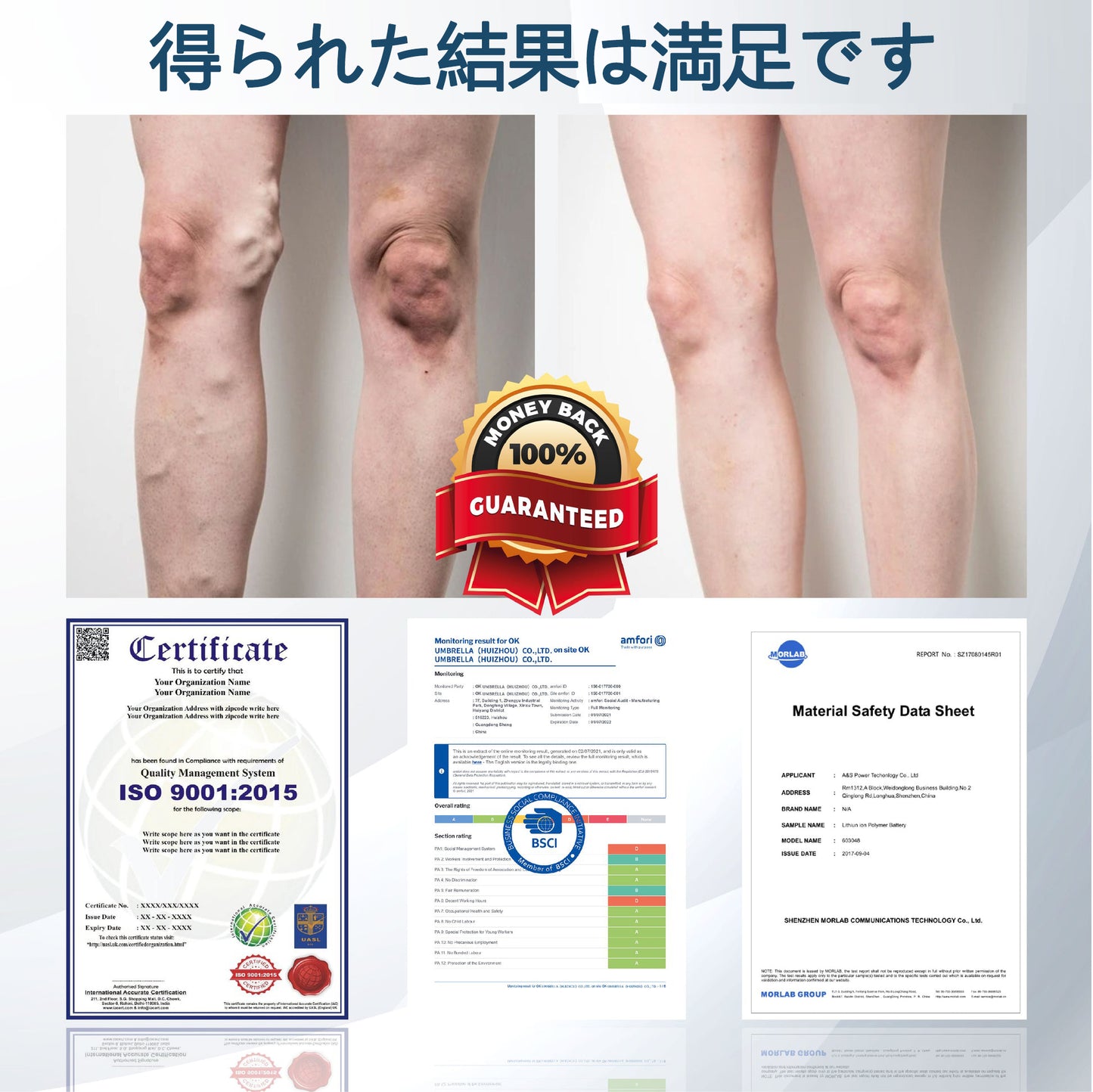 💧ATTDX® 腫れを和らげるハーブクリーム（ブラッククミン配合）