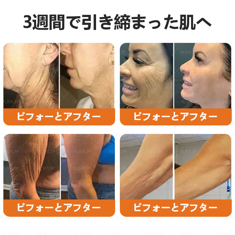 VLSVLS™ 蜂毒配合スキンクリーム（フルケアタイプ）🧑‍⚕️ 皮膚科医も推薦！ 肌トラブル全般に対応した高機能クリームです
