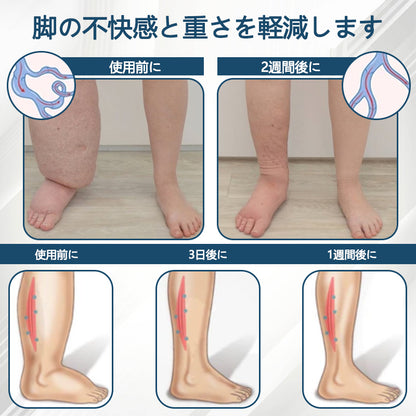 💧ATTDX® 腫れを和らげるハーブクリーム（ブラッククミン配合）