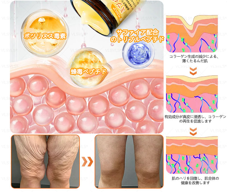 VLSVLS™ 蜂毒配合スキンクリーム（フルケアタイプ）🧑‍⚕️ 皮膚科医も推薦！ 肌トラブル全般に対応した高機能クリームです