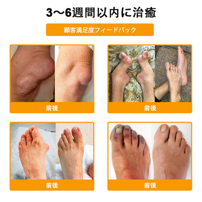 🔥🔥TLOPA®ボツリヌストキシンとビーベノムの骨の痛みを和らげ、癒すバーム🐝（整形外科医がシニアに推奨）🔥。